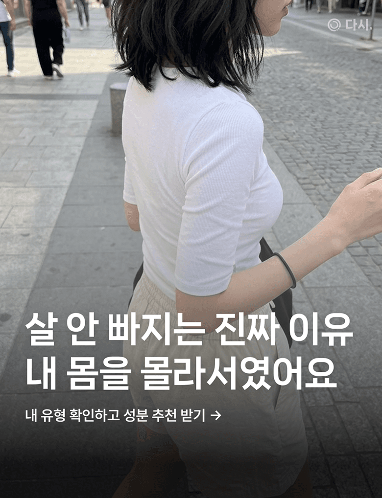 배너 5 상세 73